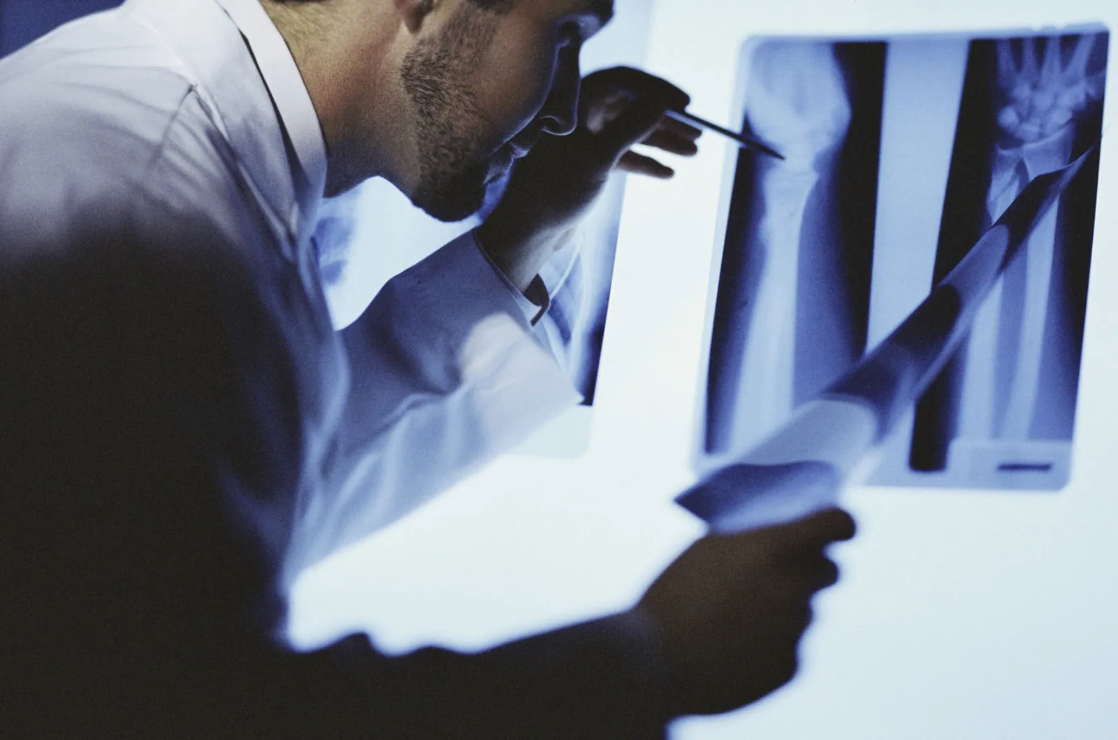 Slow bone loss from prostate cancer