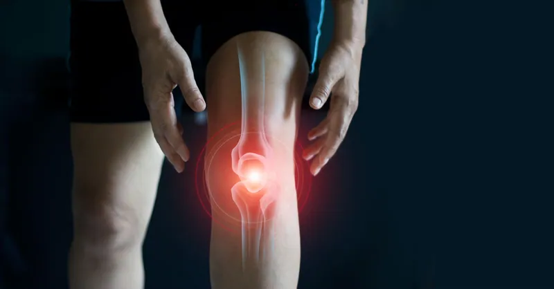 More than aches and pains: Arthritis has numerous forms and can significantly impact quality of life